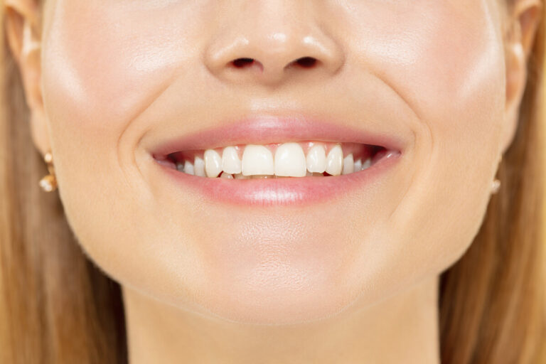 Nadwrażliwość zębów po leczeniu